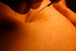 Viscera Sham piercing with acupuncture needles